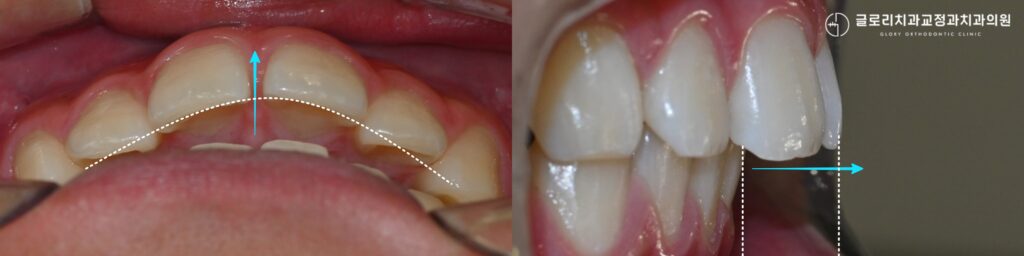 상봉역 교정치과
