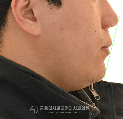 구외 임상사진 4컷 2025.12.29