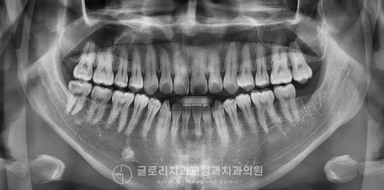 초진 파노라마